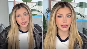 Flavia Laos revela que padece delicada enfermedad / TikTok