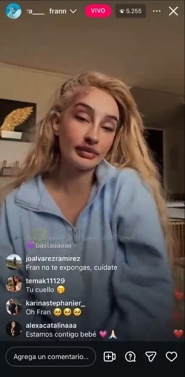 La exchica reality preocupó a sus seguidores al aparecer con visibles lesiones en el rostro Video: TikTok @vikentt La exchica reality preocupó a sus seguidores al aparecer con visibles lesiones en el rostro Video: TikTok @vikentt