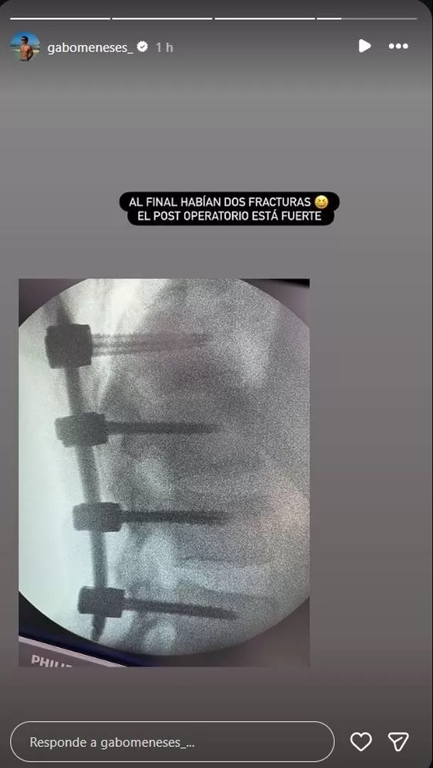 Gabriel Meneses se lesionó durante competencia en 'Esto es guerra'. Foto: Instagram Gabriel Meneses se lesionó durante competencia en 'Esto es guerra'. Foto: Instagram