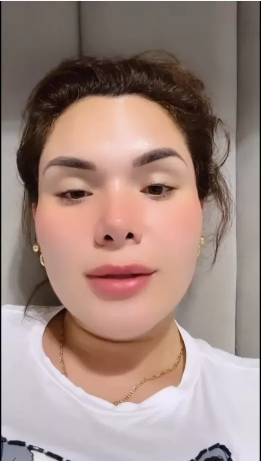 Génesis Tapia grabó un video explicando qué fue lo que le ocurrió/Foto: Instagram