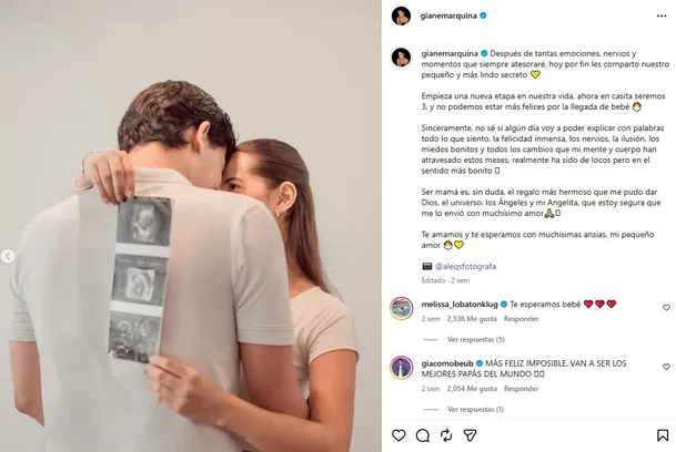 Gianella Marquina anunció su embarazo el pasado 31 de mayo de 2026 / IG: @gianemarquina Gianella Marquina anunció su embarazo el pasado 31 de mayo de 2026 / IG: @gianemarquina
