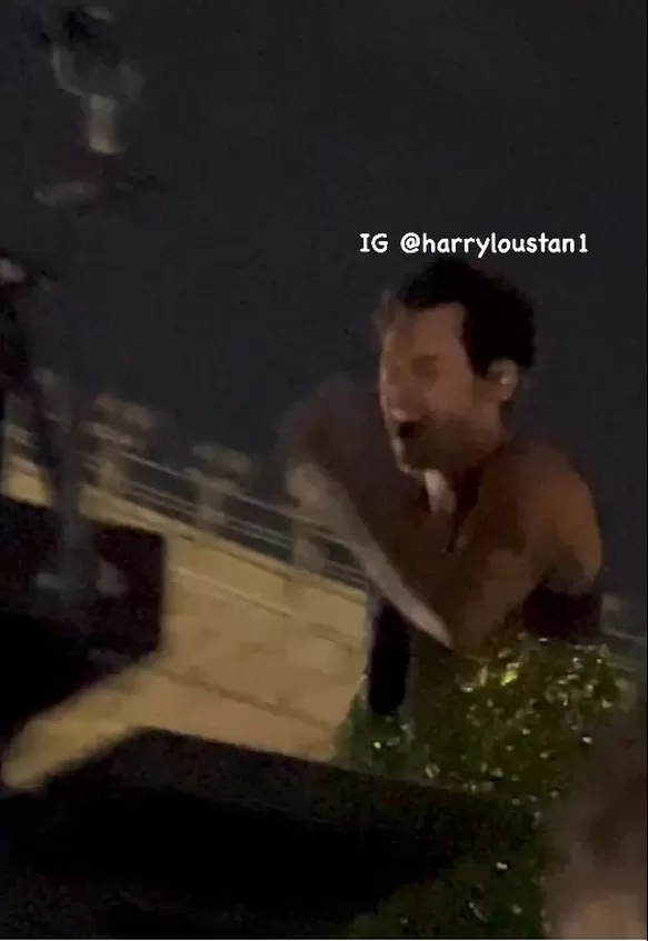 Se puede apreciar el rostro de dolor del cantante  tras  impacto en el ojo izquierdo/Foto: IG Harry Lou Stan 1