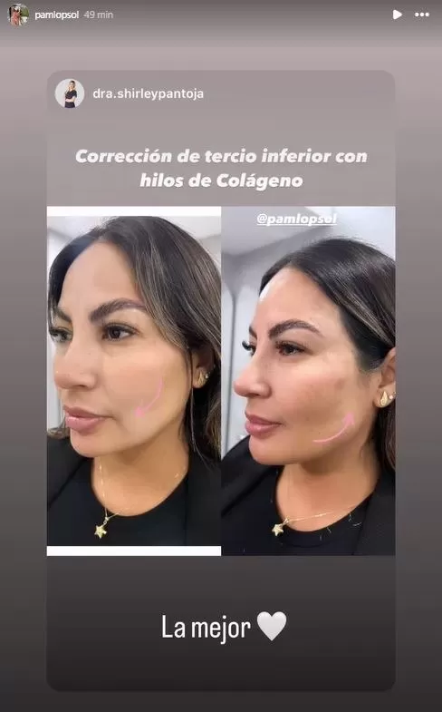 Pamela López sorprendió con nuevo retoque en el rostro. Fuente: Instagram