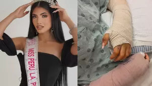 Luciana Martin, hija de Anelhí y Dayron, sufrió un accidente con fuegos artificiales en Año Nuevo. Video: TikTok