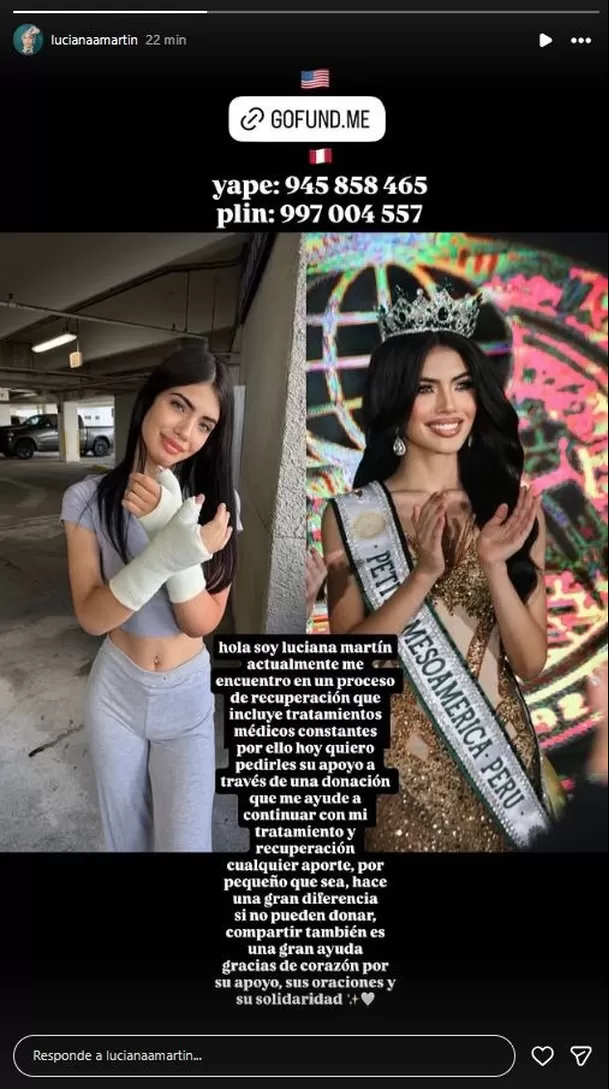 Luciana Martin, hija de Anelhí y Dayron, sufrió un accidente con fuegos artificiales en Año Nuevo. Foto: Instagram