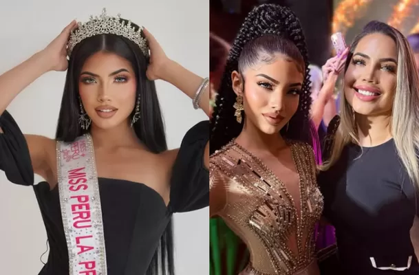 Luciana Martin, hija de Anelhí y Dayron, sufrió un accidente con fuegos artificiales en Año Nuevo. 