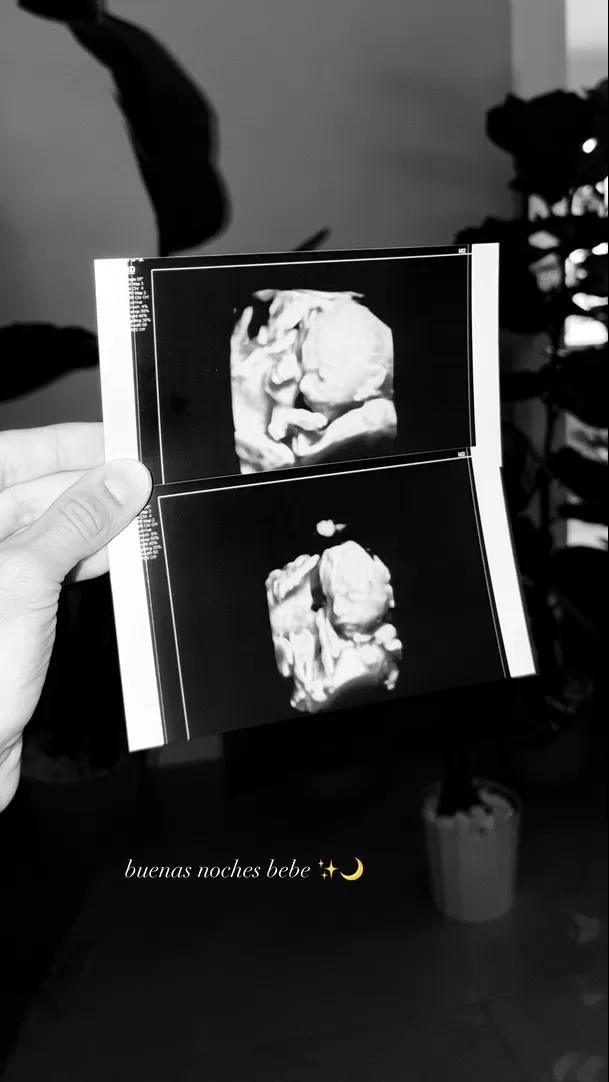 La nueva ecografía del bebé de Isabella Ladera y Hugo García / Instagram