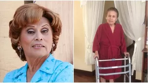 Irma Maury reveló grave accidente que sufrió en su casa / Facebook 