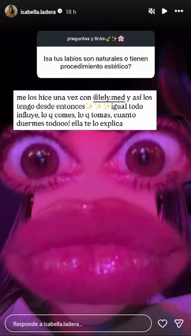 Ladera confiesa qué retoque estético se realizó en el rostro / IG: isabella.ladera