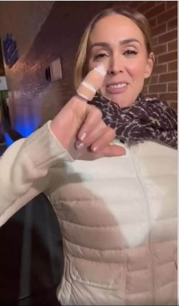 Jacqueline Bracamontes mostró cómo quedó su dedo tras sufrir corte. Fuente: Instagram