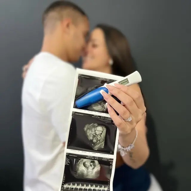Melissa Klug y Jesús Barco emocionaron a sus seguidores con el anuncio de su embarazo. Fuente: Instagram