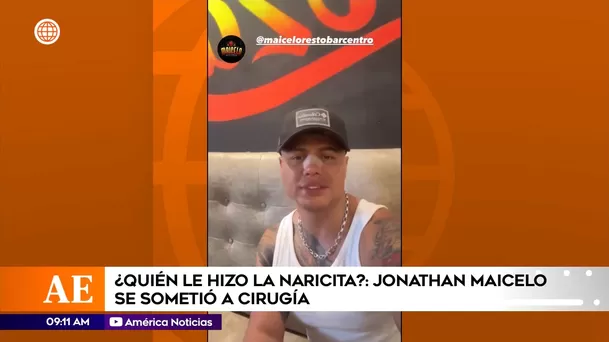 Jonathan Maicelo mostró el resultado de su rinoplastia / Instagram