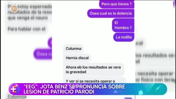 Jota Benz destacó a otros integrantes del equipo/ América TV