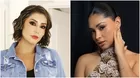 Karla Tarazona se sometió a retoquito en el rostro y es comparada con Pamela Franco