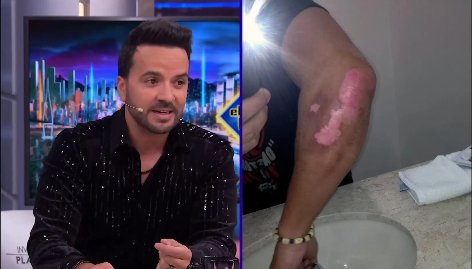 Luis Fonsi recordó un accidente que tuvo lugar en Argentina hace 13 años/Foto: 'El Hormiguero'