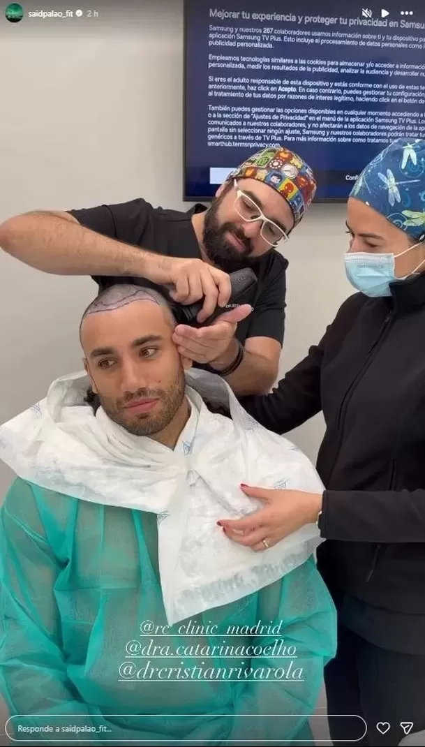 Said Palao se rapó por completo para someterse a trasplante capilar en Madrid / Instagram