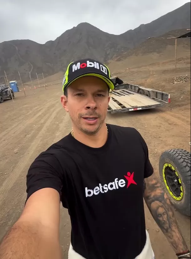 Mario Hart dijo que vivirá medicado tras tumor en la cabeza/ Foto: Captura Instagram
