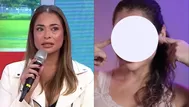 Melanie Martínez mostró resultado final tras cirugía de párpados