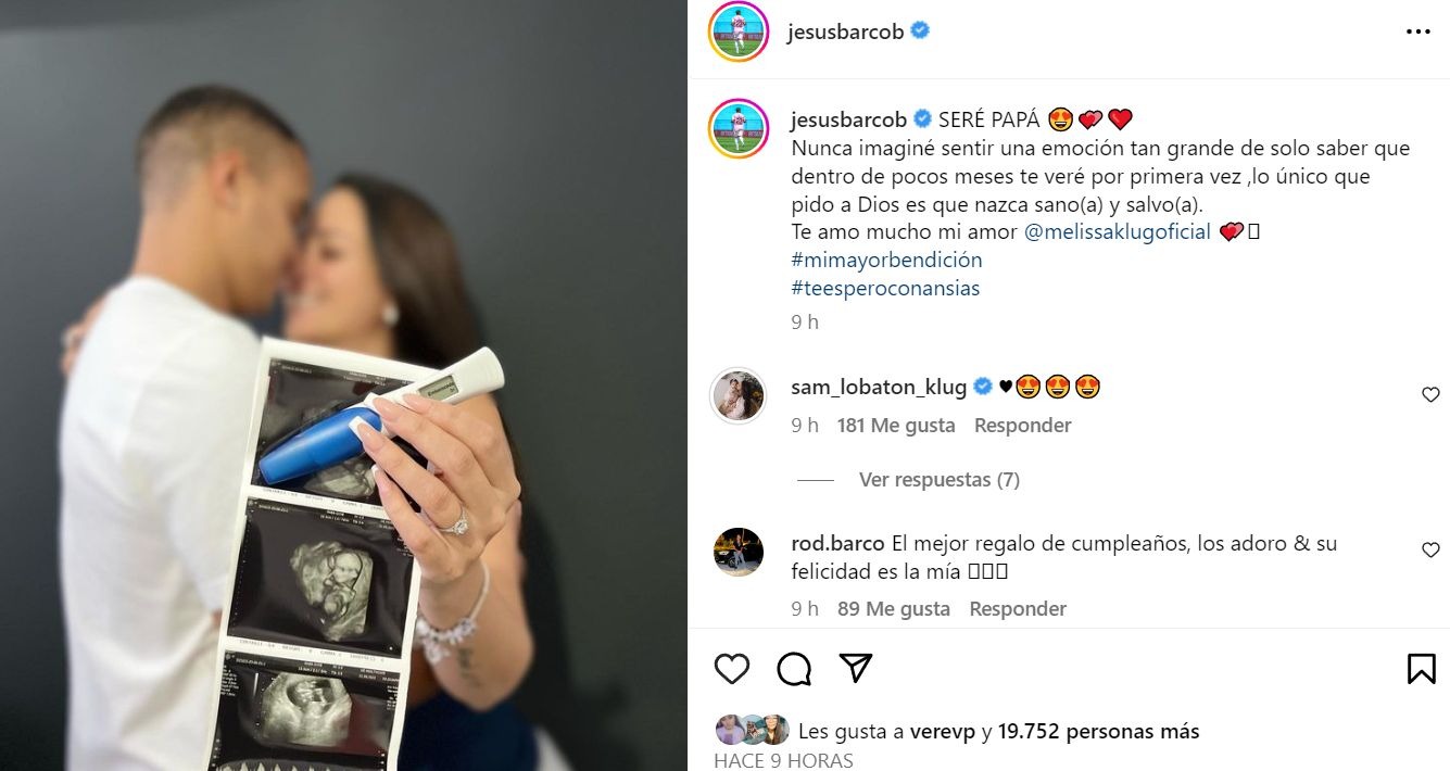 Melissa Klug Anunció Su Embarazo Con Amorosa Foto Junto A Jesús Barco América Noticias 9929