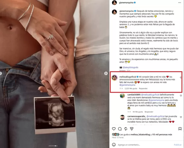 Melissa Klug no ocultó su emoción tras el anuncio del primer embarazo de Gianella Marquina / Foto: Instagram @gianemarquina Melissa Klug no ocultó su emoción tras el anuncio del primer embarazo de Gianella Marquina / Foto: Instagram @gianemarquina