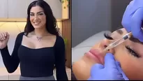 Michelle Soifer mostró el resultado de su aumento de labios/Fotos: Instagram/Video: Más Espectáculos