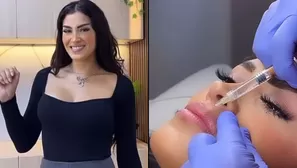 Michelle Soifer mostró el resultado de su aumento de labios/Fotos: Instagram/Video: Más Espectáculos