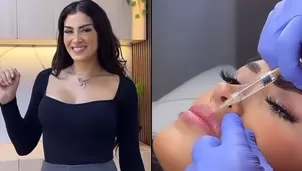 Michelle Soifer mostró el resultado de su aumento de labios/Fotos: Instagram/Video: Más Espectáculos