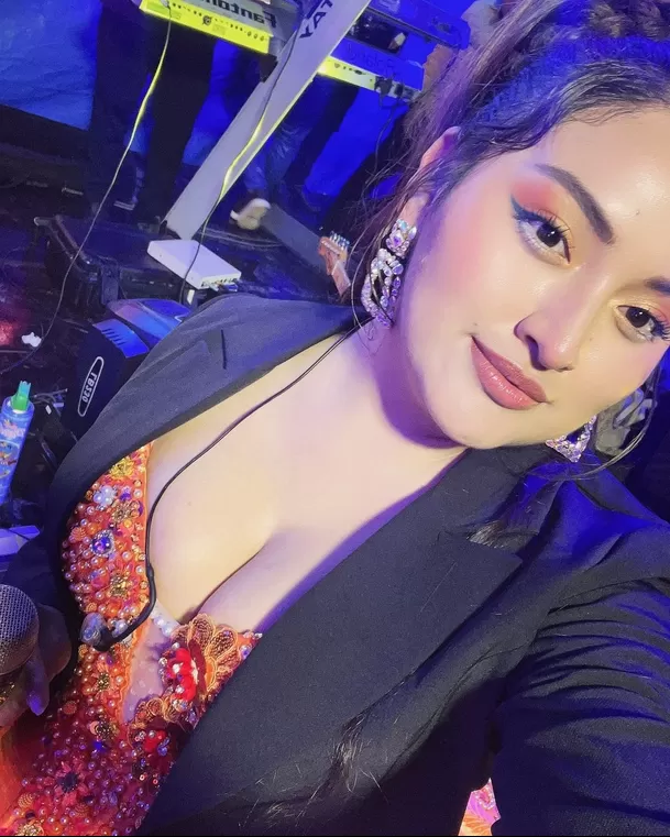 La cantante Flor Sheiza, conocida como 'Muñequita Milly', se sometió a una cirugía el 27 de marzo a manos del doctor Fong / Instagram