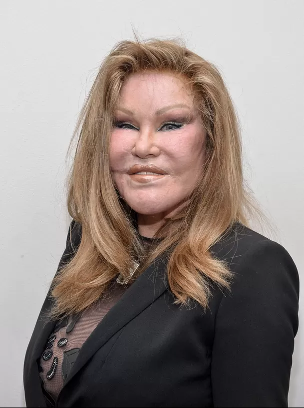 Jocelyn Wildenstein, conocida como 'La mujer gato', murió a los 79 años. Fuente: AFP