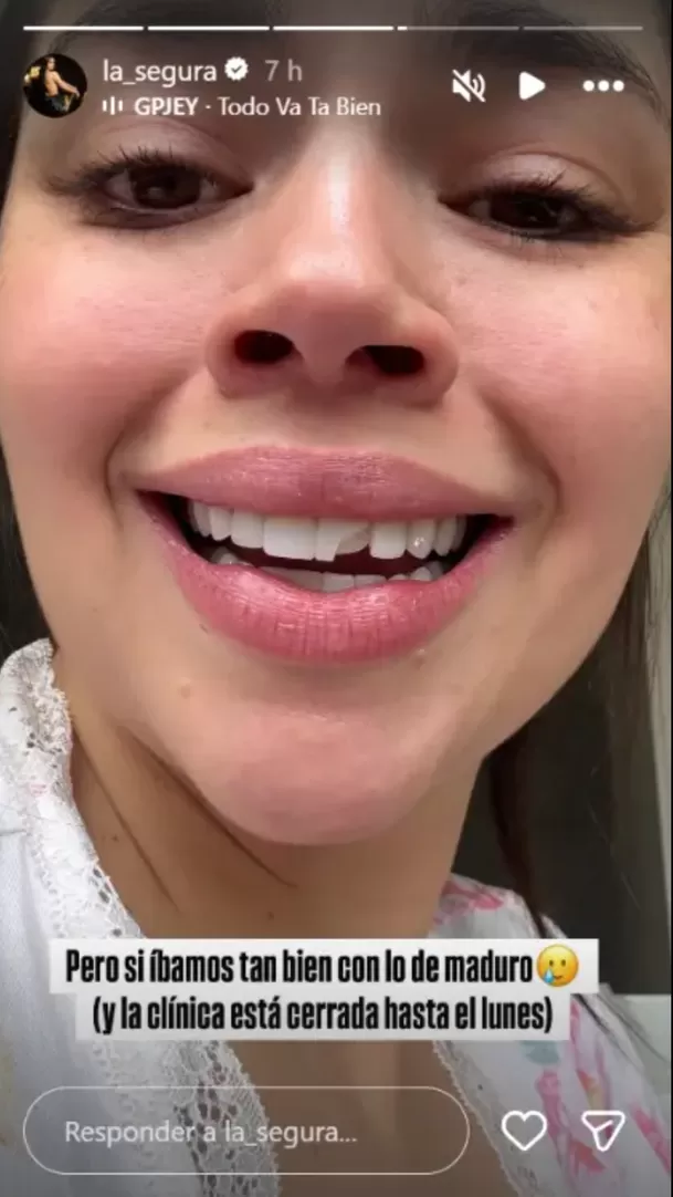La influencer colombiana interrumpió dinámica con sus fans para mostrar cómo quedó tras accidente dental. Foto: Instagram La influencer colombiana interrumpió dinámica con sus fans para mostrar cómo quedó tras accidente dental. Foto: Instagram