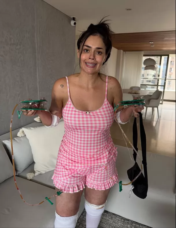 Natalia Segura  muestra los resultados tras su operación / Instagram