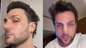 Nicola Porcella revela detalles de su nuevo retoque en la nariz/ América TV