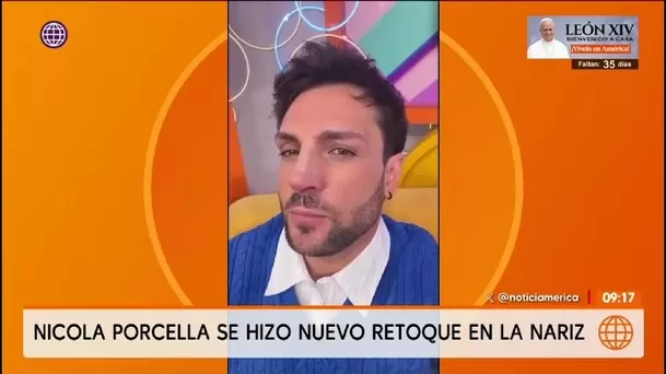 Nicola Porcella contó que se sometió a un nuevo retoque en la nariz y desmintió fotos falsas/ América TV Nicola Porcella contó que se sometió a un nuevo retoque en la nariz y desmintió fotos falsas/ América TV