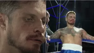 Nikko Ponce pidió revancha contra Jenko del Río. Foto: YouTube