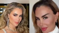 Ninel Conde cambió color de sus ojos con operación