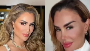 Ninel Conde cambió color de sus ojos con operación / América Espectáculos / Instagram