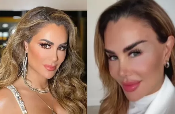 La actriz y cantante Ninel Conde se operó en Nueva York y aseguró sentirse satisfecha con el resultado / Instagram La actriz y cantante Ninel Conde se operó en Nueva York y aseguró sentirse satisfecha con el resultado / Instagram