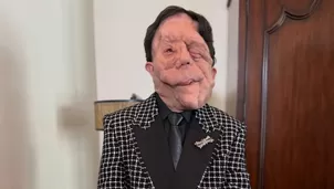 El actor británico desfiló en la alfombra roja de los premios Oscar y generó gran interés en el público / Instagram