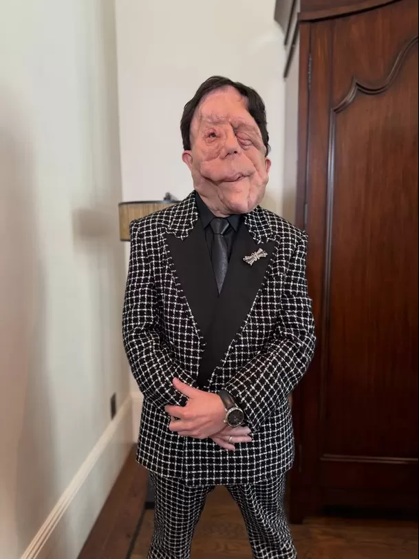 El actor británico Adam Pearson asistió a la gala de los premios Oscar 2026 y visibilizó su condición / Instagram El actor británico Adam Pearson asistió a la gala de los premios Oscar 2026 y visibilizó su condición / Instagram