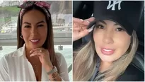 Pamela López se sometió a nuevo retoque estético. Fuente: Instagram