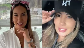 Pamela López se sometió a nuevo retoque estético. Fuente: Instagram