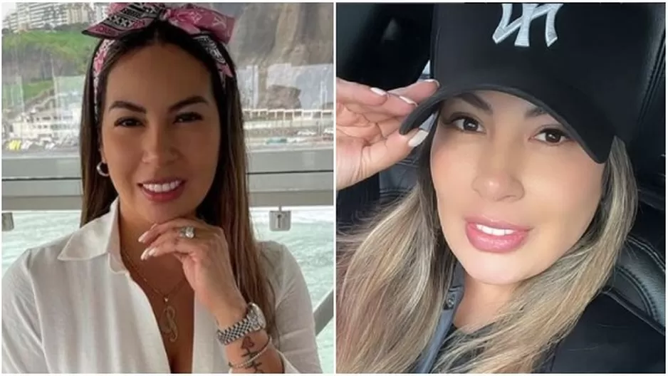 Pamela López se sometió a nuevo retoque estético. Fuente: Instagram