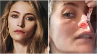 Paris Jackson mostró cómo consumo de drogas perforó su tabique