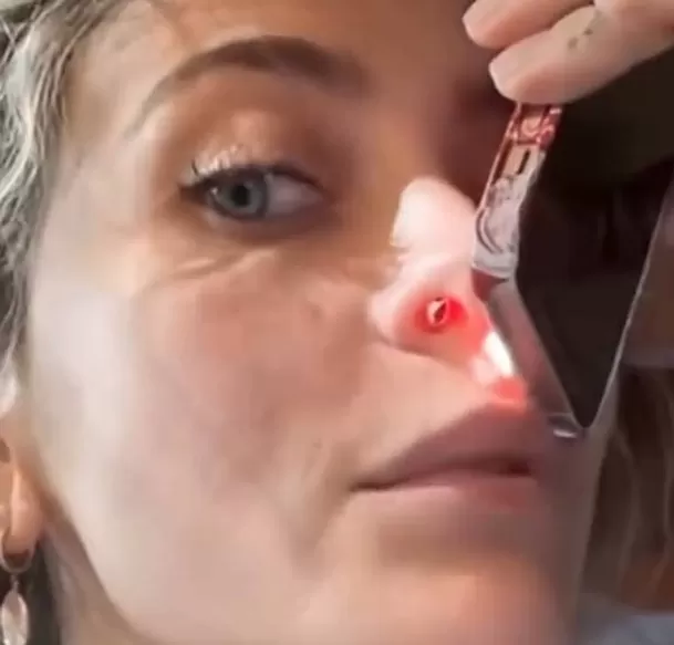 Paris Jackson revela secuelas físicas de su adicción / Instagram Paris Jackson revela secuelas físicas de su adicción / Instagram