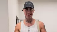 Paul Michael sorprende tras someterse a retoquito en el rostro