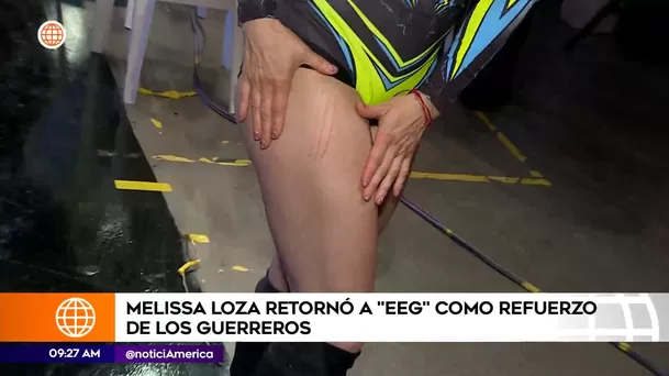 Las heridas de guerra de Melissa Loza en su primer día como refuerzo de los Guerreros / América Espectáculos