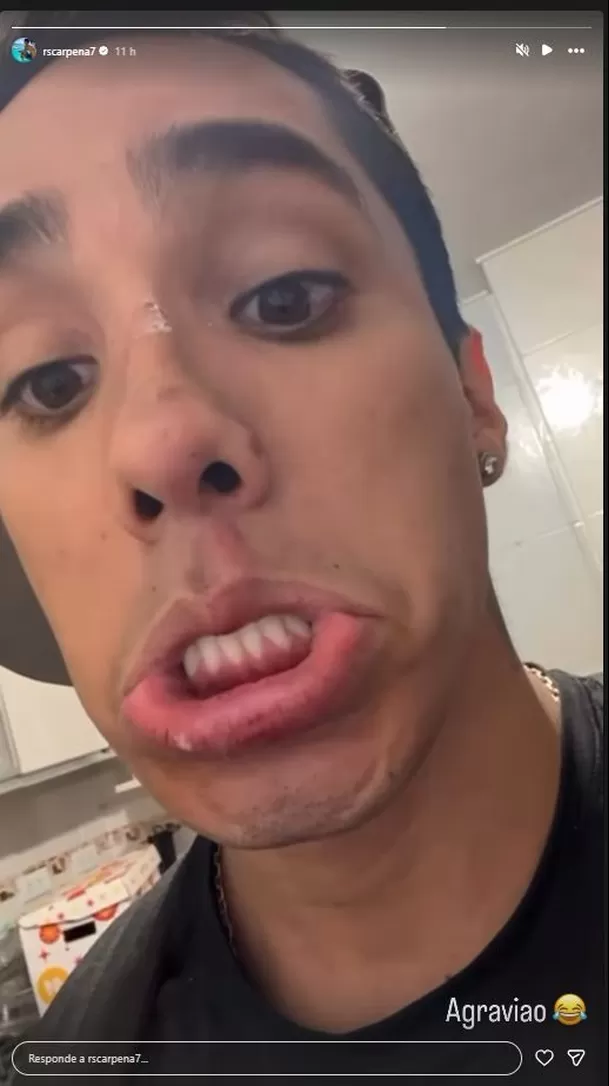 El competidor de EEG preocupó tras su caída y mostró su rostro golpeado en redes. Foto: América TV / Video: Instagram El competidor de EEG preocupó tras su caída y mostró su rostro golpeado en redes. Foto: América TV / Video: Instagram