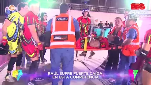 El competidor de EEG preocupó tras su caída y mostró su rostro golpeado en redes. Foto: América TV / Video: Instagram El competidor de EEG preocupó tras su caída y mostró su rostro golpeado en redes. Foto: América TV / Video: Instagram