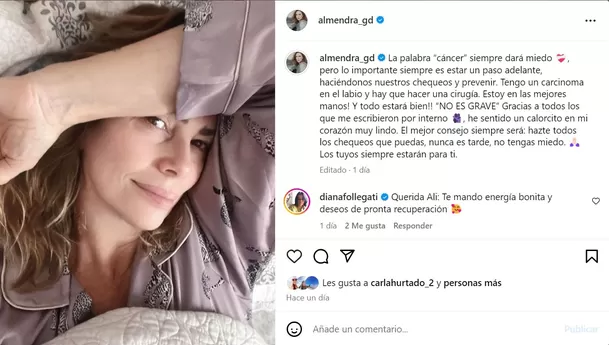 Almendra Gomelsky anunció en Instagram que se someterá a una cirugía por el cáncer que le han detectado en el labio/Foto: Instagram