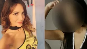 Rosángela Espinoza revelas fotos de su pasado tras controversia por cirugías